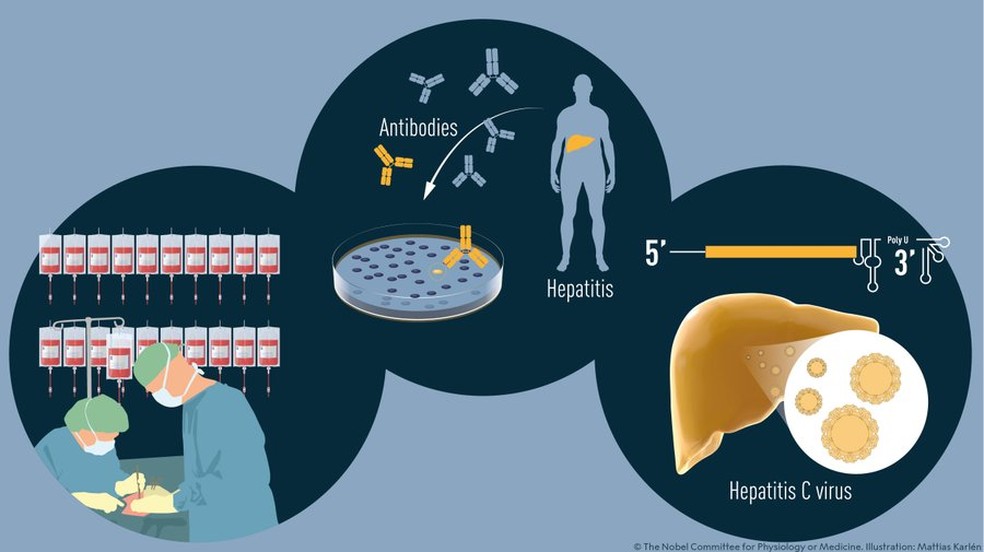 Harvey J. Alter, Michael Houghton e Charles M. Rice fizeram descobertas seminais que levaram à identificação de um novo vírus, o vírus da hepatite C. — Foto: Nobel