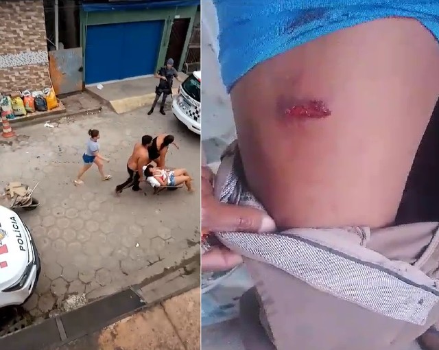 Jovem é baleada na barriga e socorrida em carrinho de mão durante perseguição policial em SP