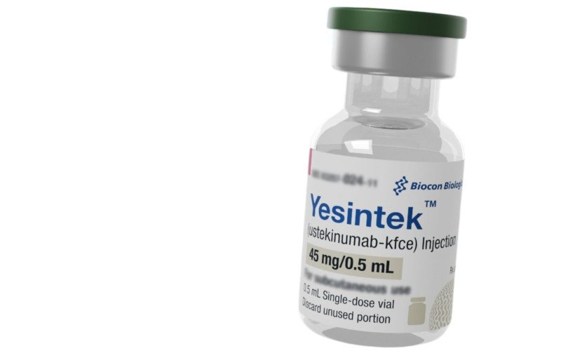 Anvisa dá sinal verde a novos tratamentos para psoríase e asma; veja detalhes