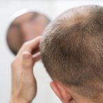 Café e queda de cabelo: o que revela a Anvisa?