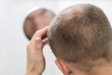 Café e queda de cabelo: o que revela a Anvisa?