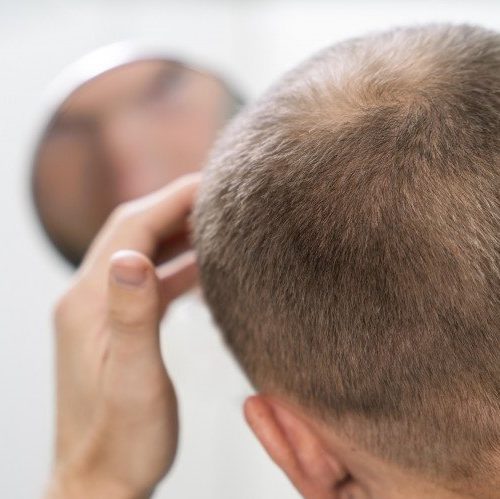 Café e queda de cabelo: o que revela a Anvisa?
